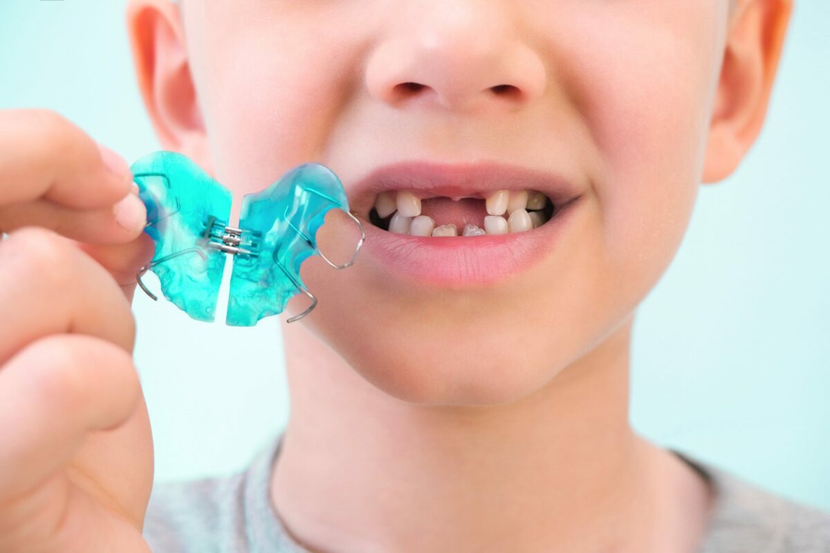 orthodontie enfants et adultes Aix-en-Provence